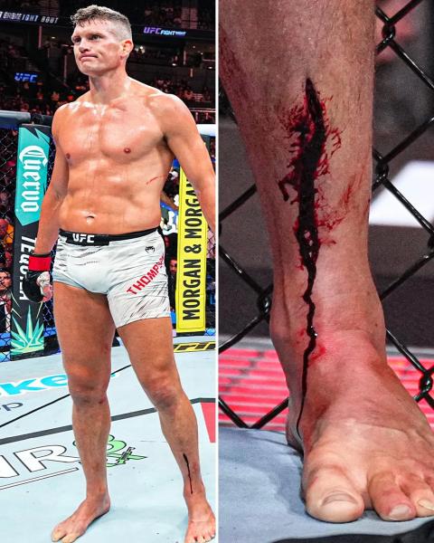 Стивен Томпсон рассек ногу в поединке на UFC on ESPN 70